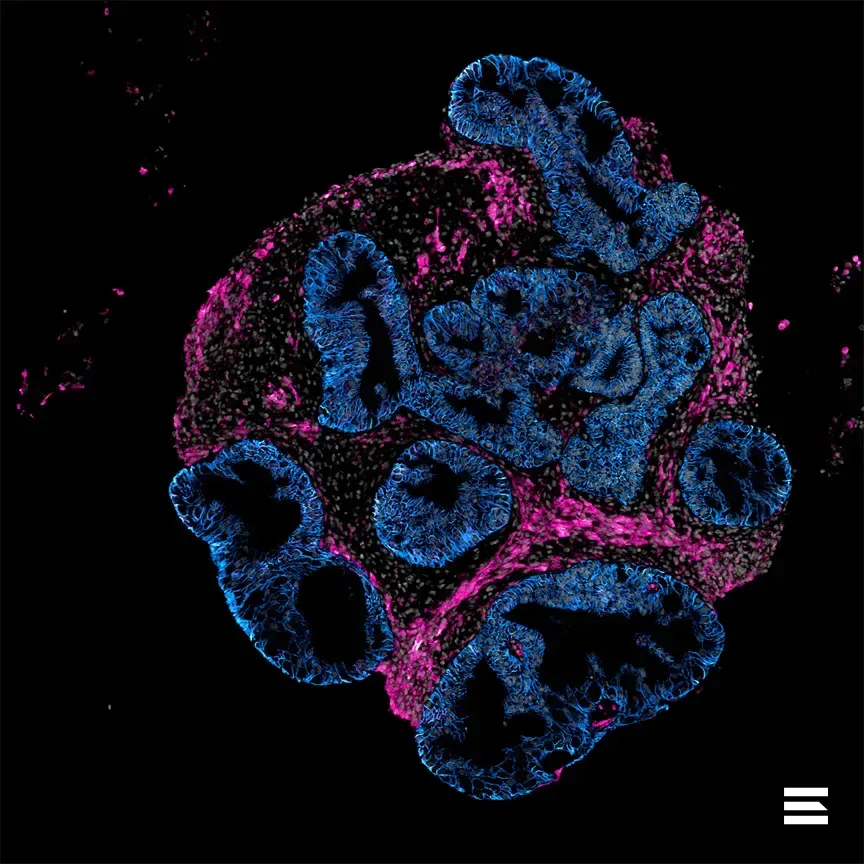 Intero Biosystems предлагает кишечники человека для тестов вместо животных